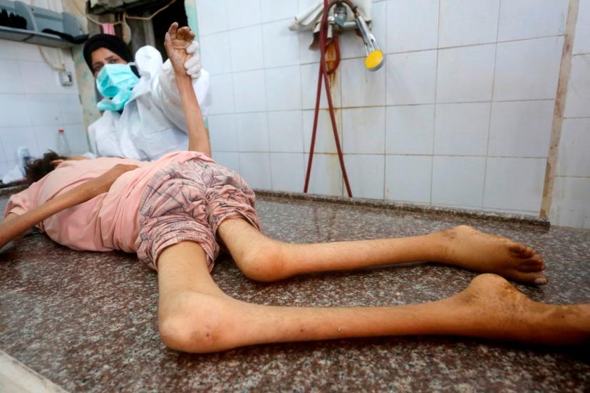 Bir çocuk daha İsrail'in açlık savaşının kurbanı oldu
