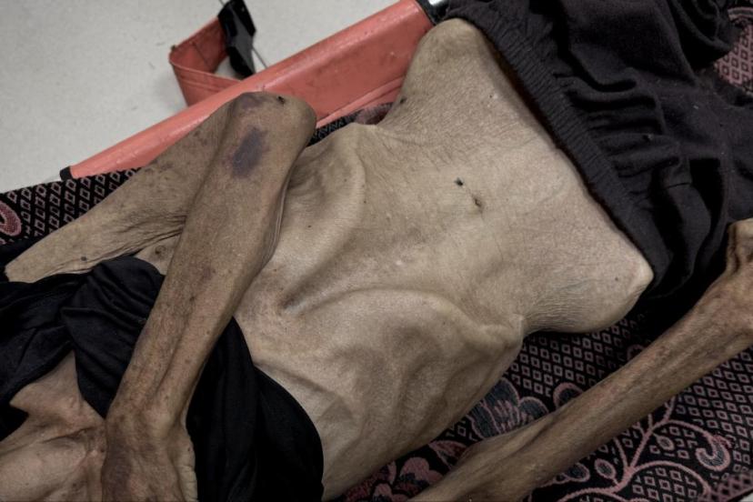 İsrail'in kıtlığı dayattığı Gazze'de son 24 saatte 5 kişi daha açlıktan hayatını kaybetti