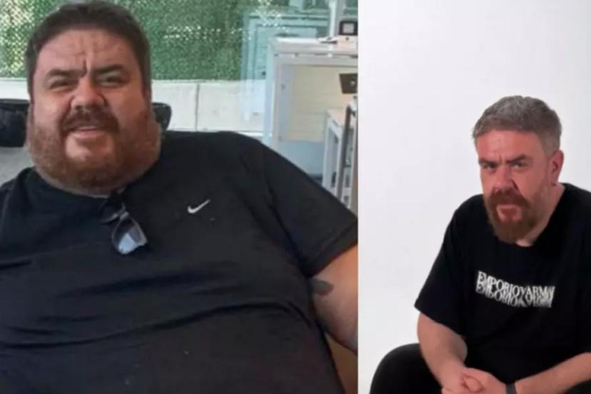 Komedyen Emre Mutlu'nun son hali şaşırttı! 133 kilo verdi