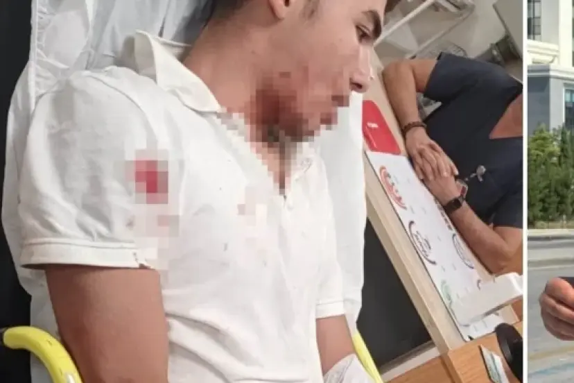 ‘Ne bakıyorsun’ tartışması kanlı bitti: 14 yaşındaki genç hastanelik oldu