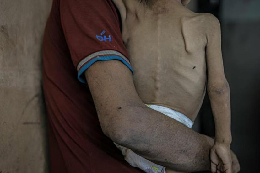 UNRWA Genel Komiseri: Gazzede açlık herkesi yavaş ve sessiz bir ölüme mahkum etti