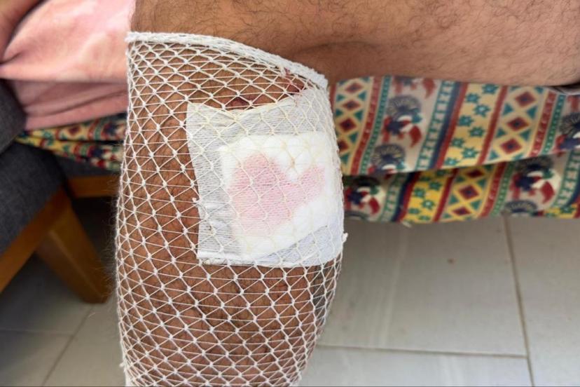 Yürüyüş yaparken başıboş sokak köpeklerinin saldırısına uğradı